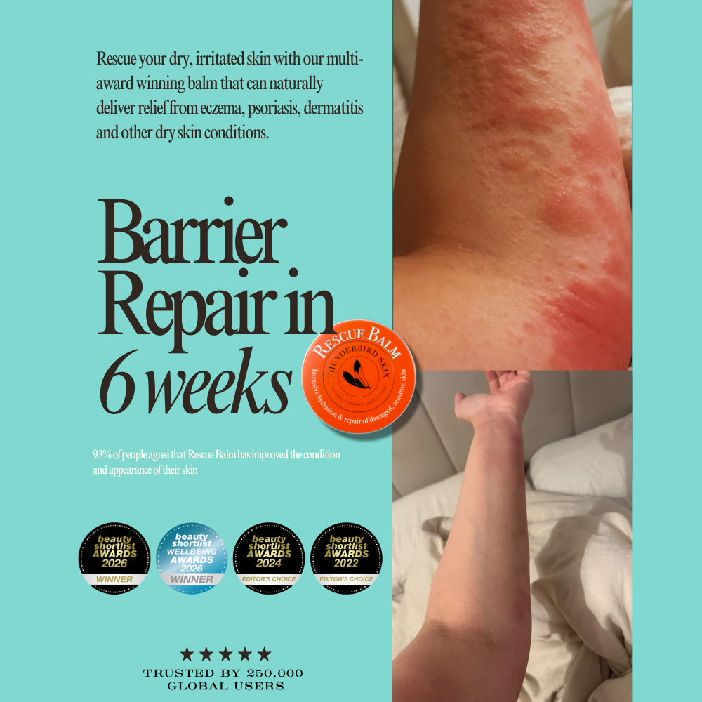 Rescue Balm for hives and Irritated Skin