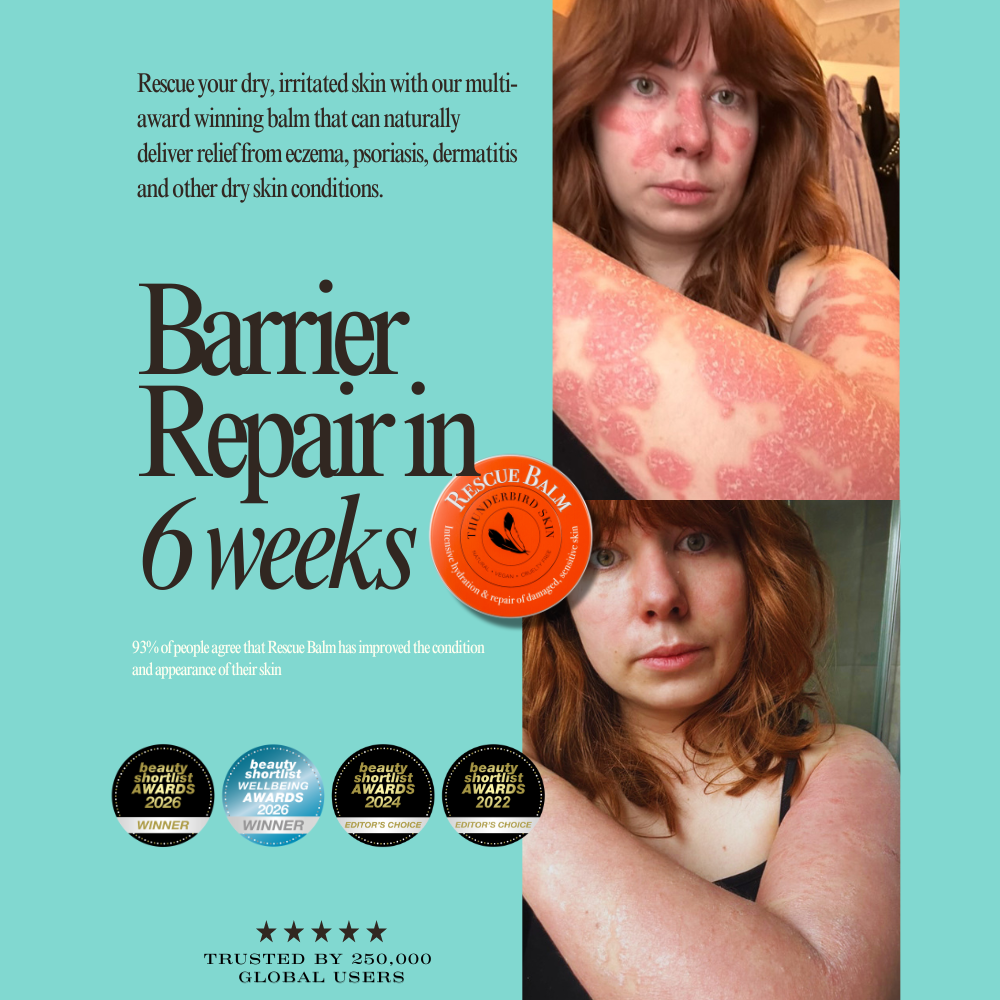 Rescue Balm for  hives and Irritated Skin