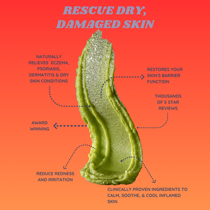 Rescue Balm for  hives and Irritated Skin